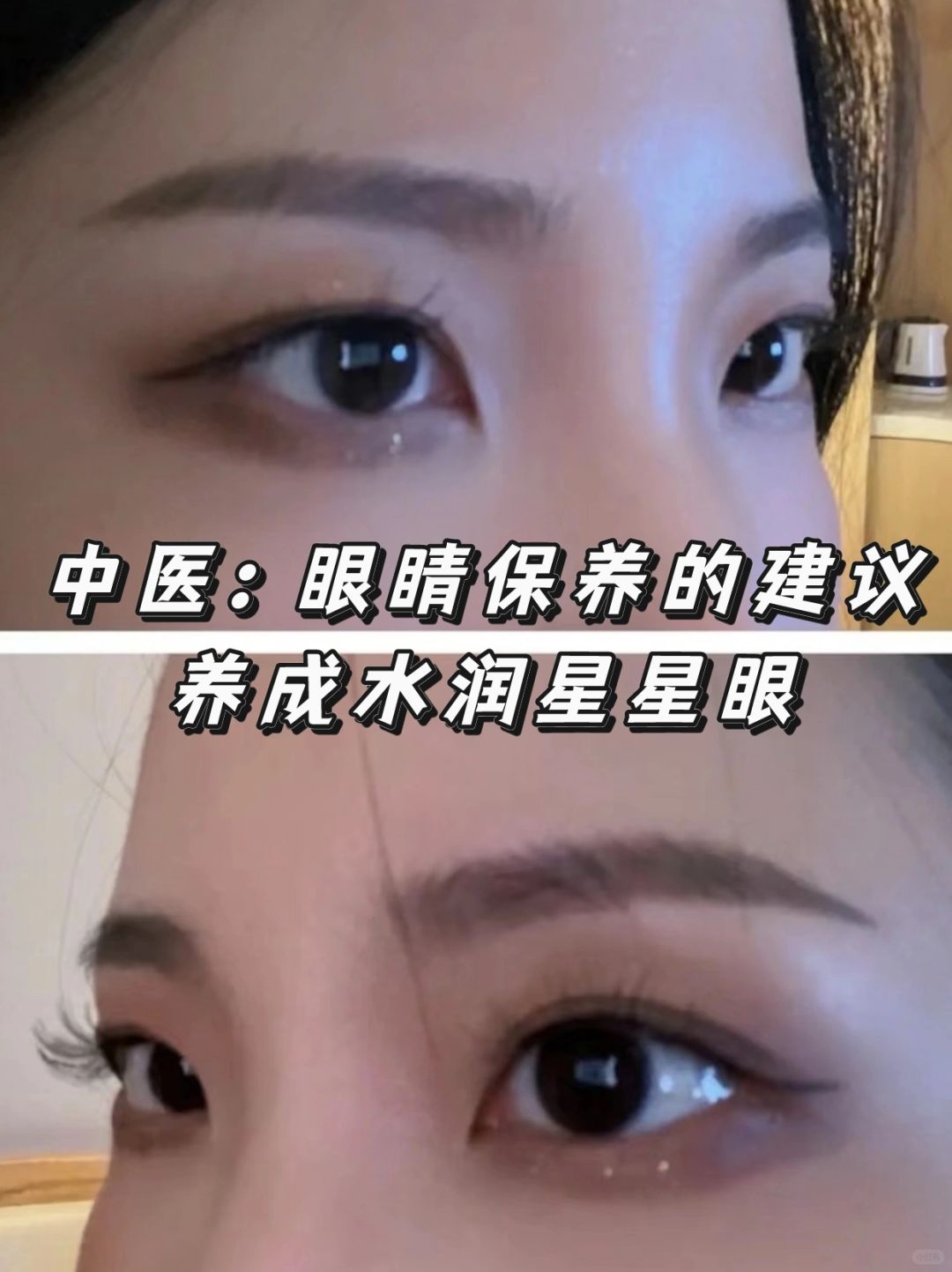 中医：眼睛年轻，越来越水润有神的方法
