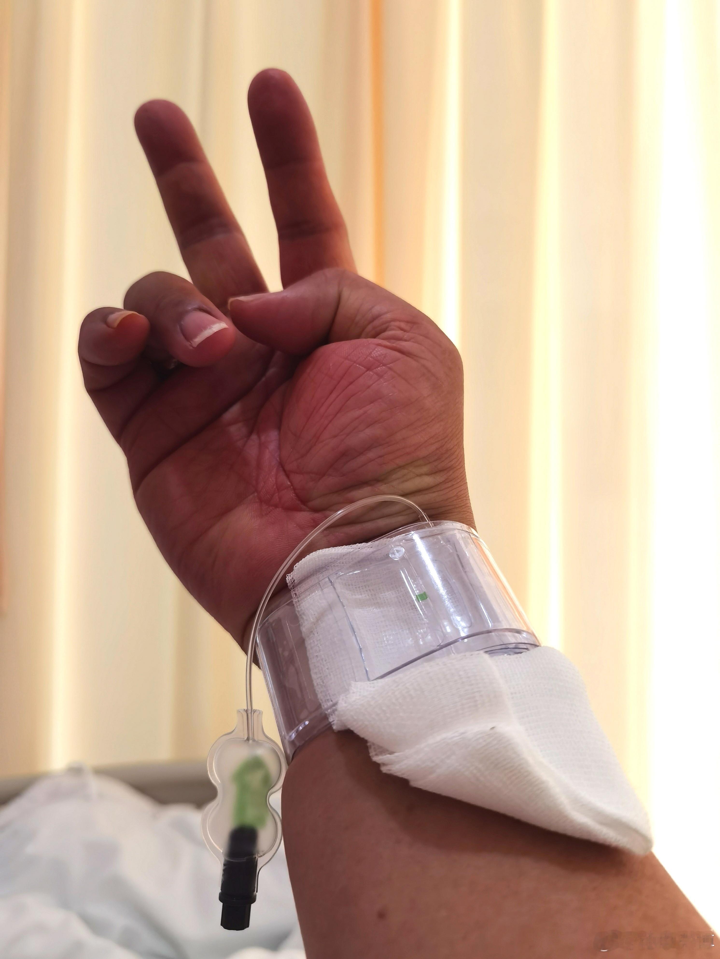 刚从手术室出来，第二次心脏介入手术顺利完成上午9点进入手术室，等待1小时开始，1