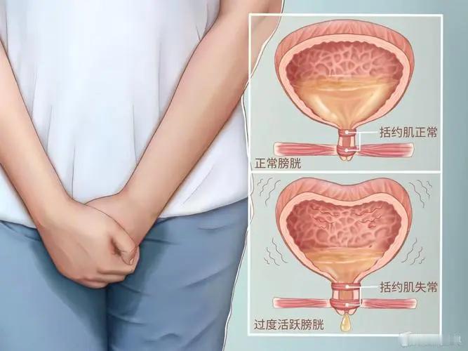 为什么一咳嗽就漏尿？多半是肾的责任

中医认为，肾脏与泌尿系统有着密切的联系。肾