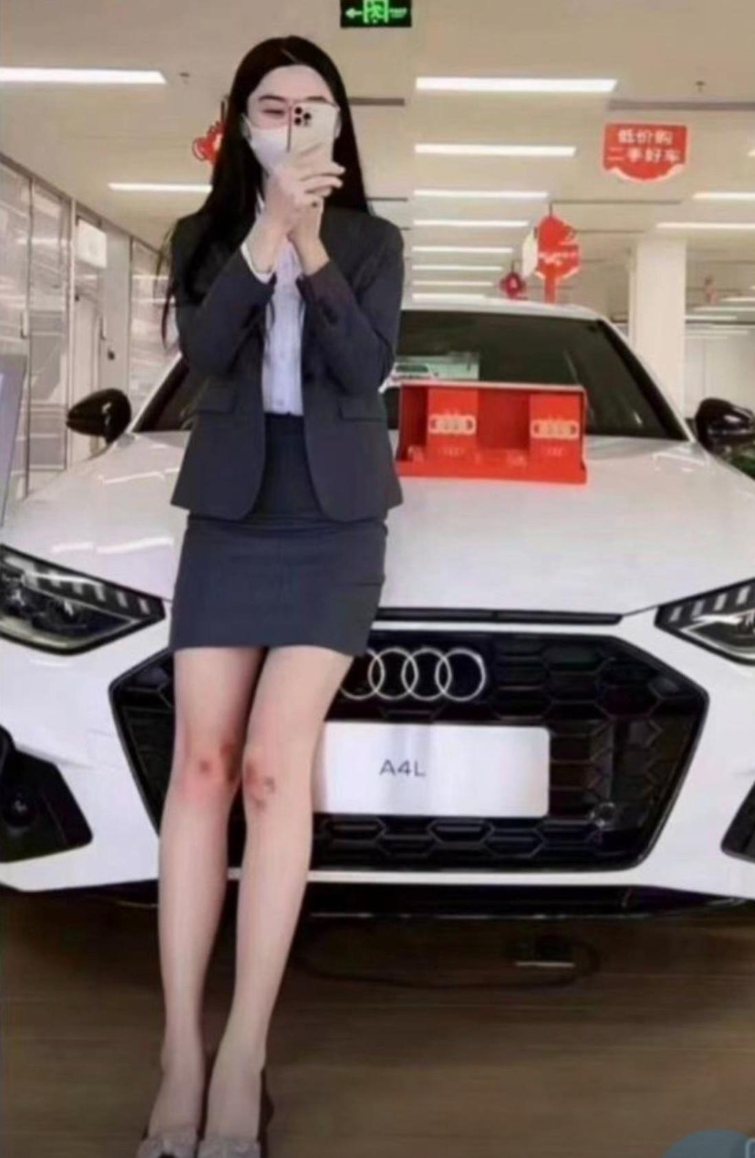 以前总以为她是口才好、懂车专业，直到刷到她发的朋友圈自拍，膝盖上那两块显眼的淤青
