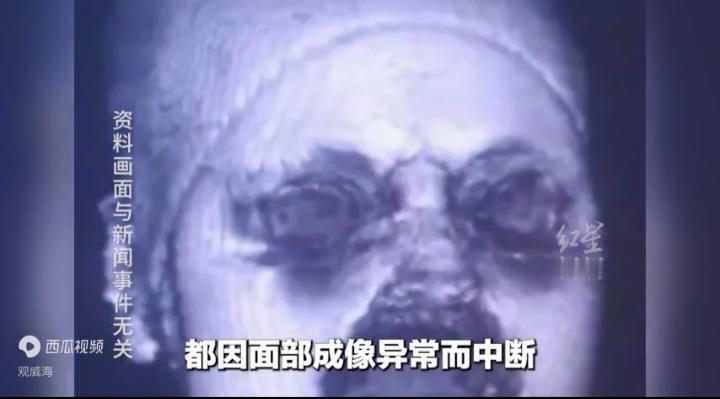 女子头晕，做头颅磁共振连续两次卡壳，医生夺命三连问，女子接连否认，医生懵了，没想