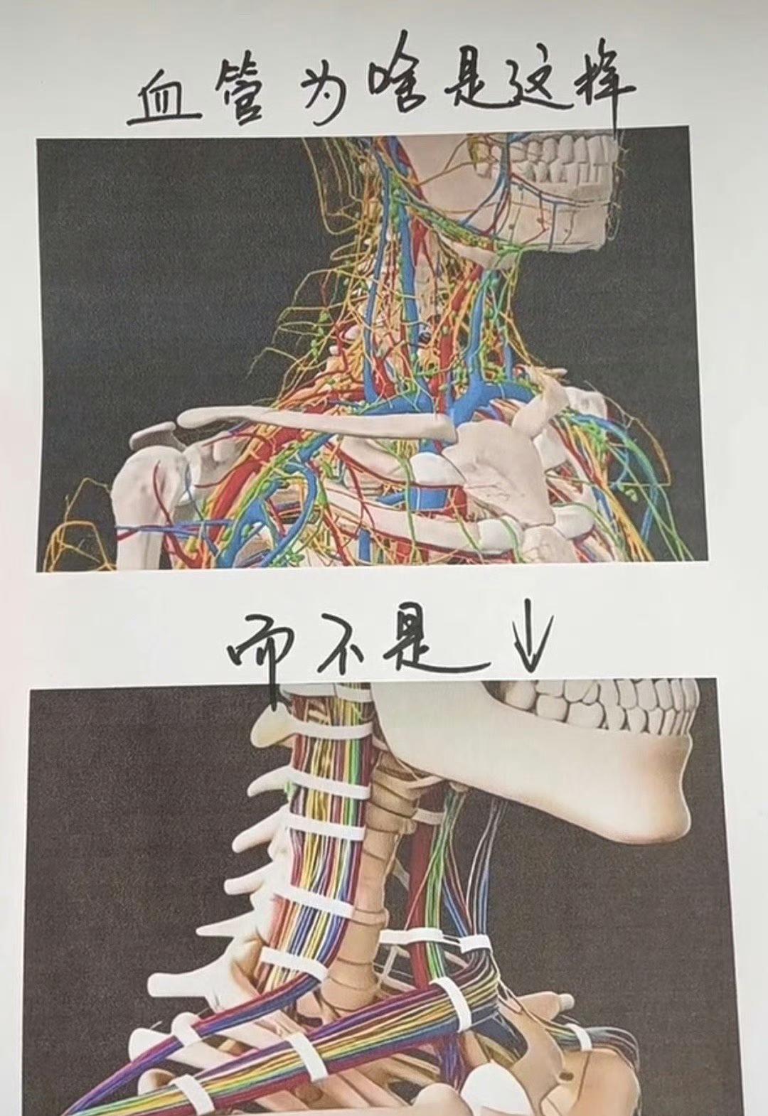 人类大脑神奇的血管！
杀手：很好地解决了一刀无法毙命的困扰！
癌细胞：克服了短时