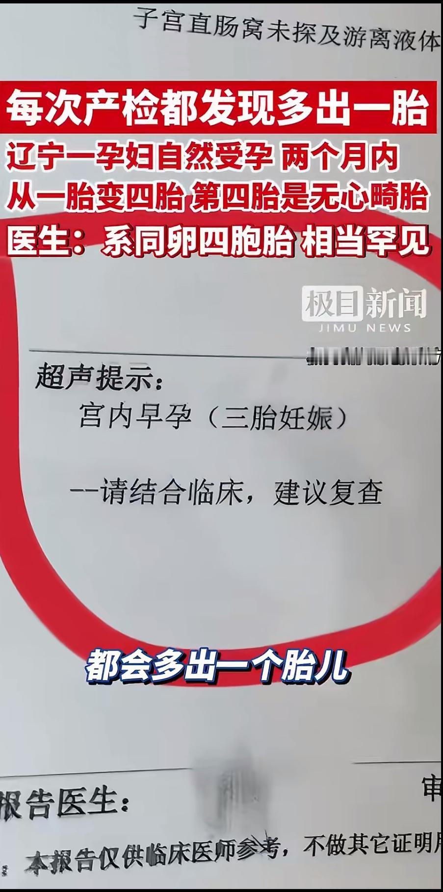 近日，辽宁一位孕妇的经历引发全网关注：她在两个月内的三次产检中，胎儿数量从一胎逐