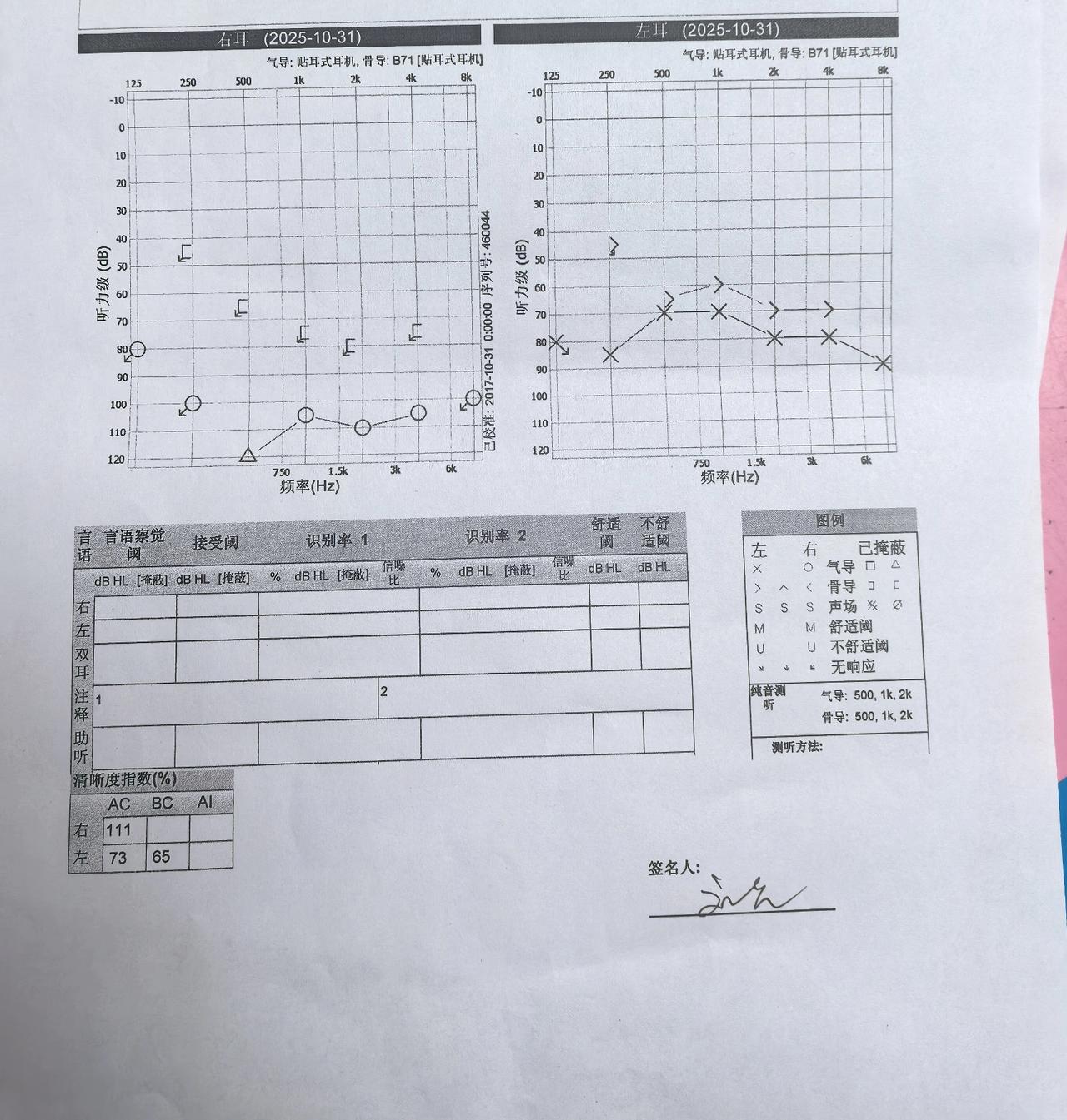 家中老人突发性耳聋，平时有高血压和糖尿病，耳聋前头晕呕吐，在完全听不到的当天去了