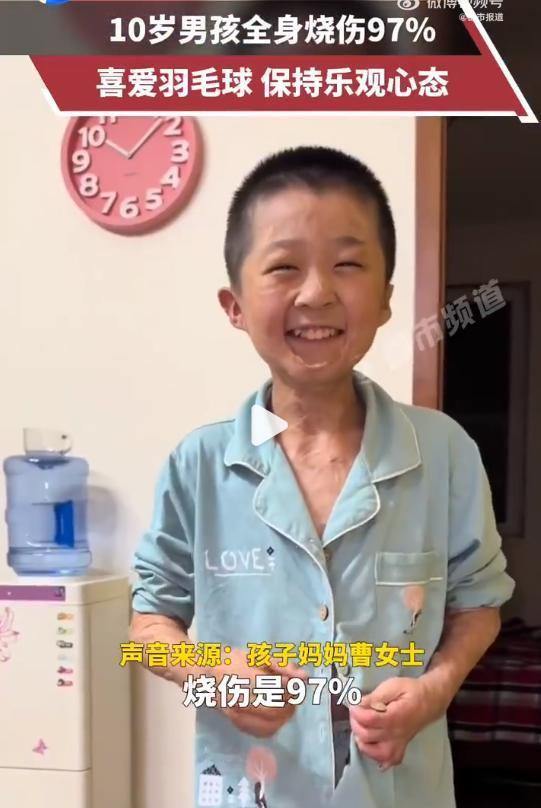 好样的孩子！11月25日采访，山东。3年前家中意外失火，一家4口被烧伤，10岁男