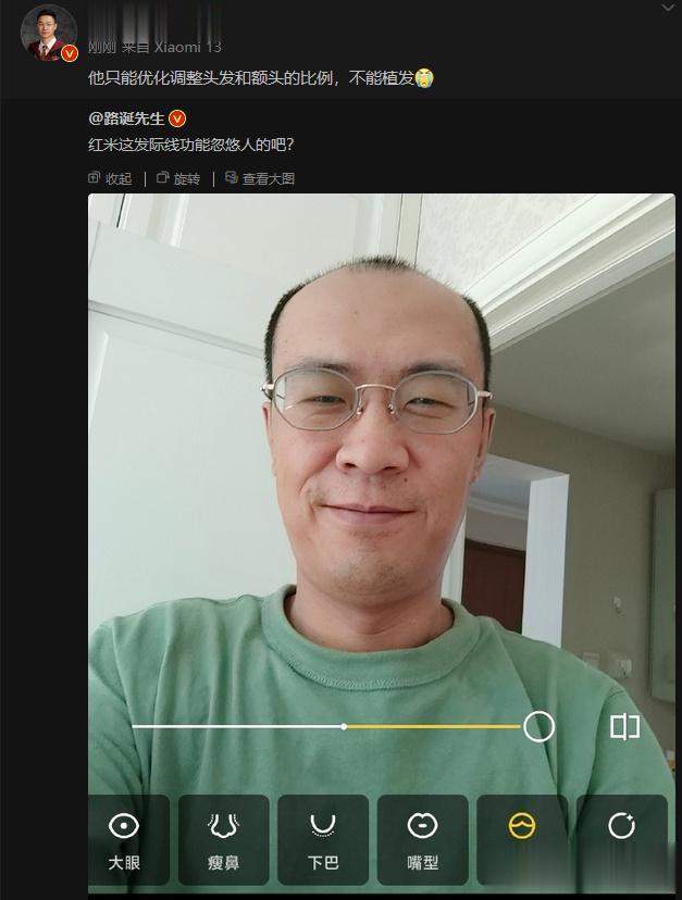 一键植发功能，美颜新方向，建议各大厂商速速研发跟进[狗头]