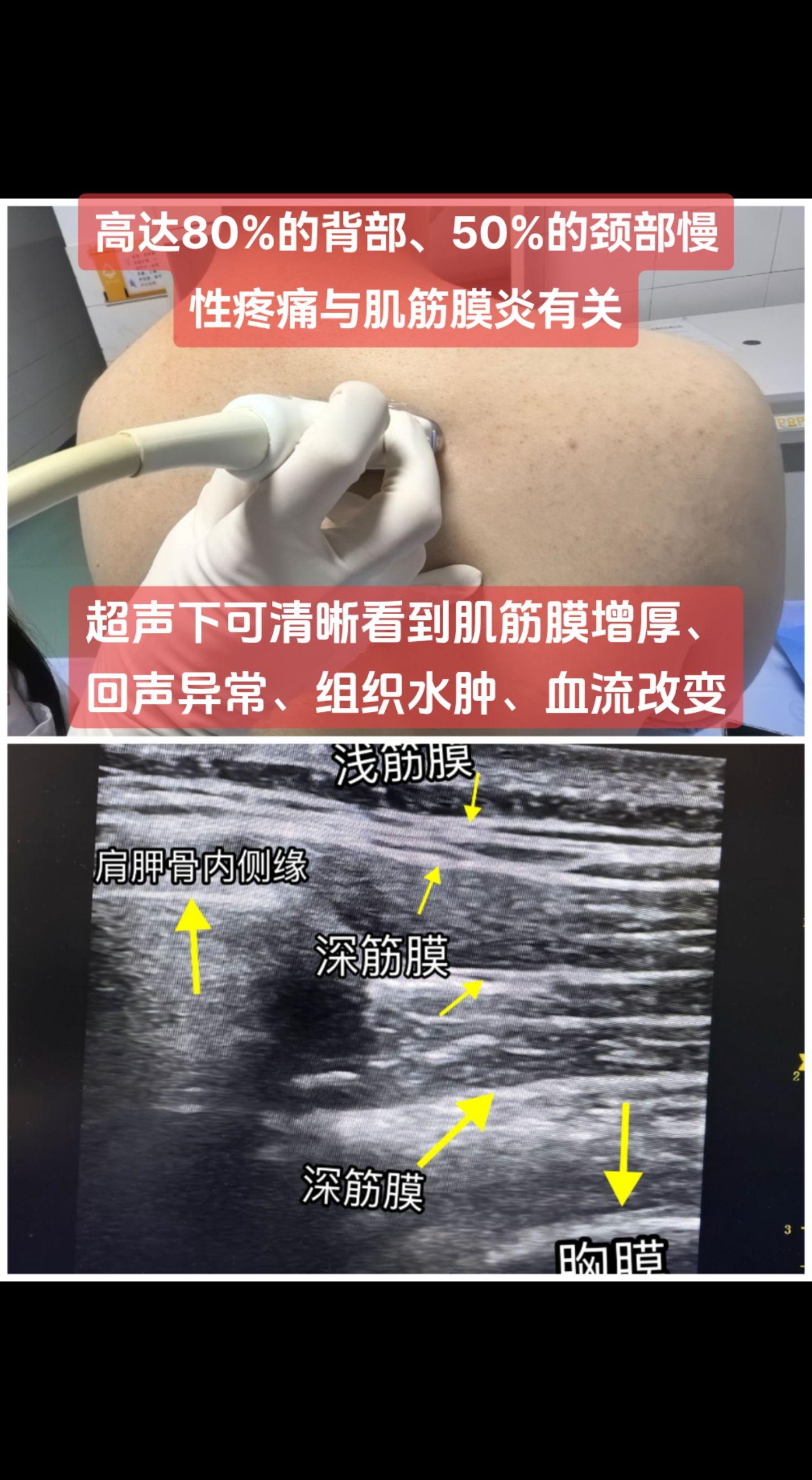 长时间埋头、坐姿不正、缺乏锻炼，是主要的致病因素，其中罪魁祸首当属沉迷...