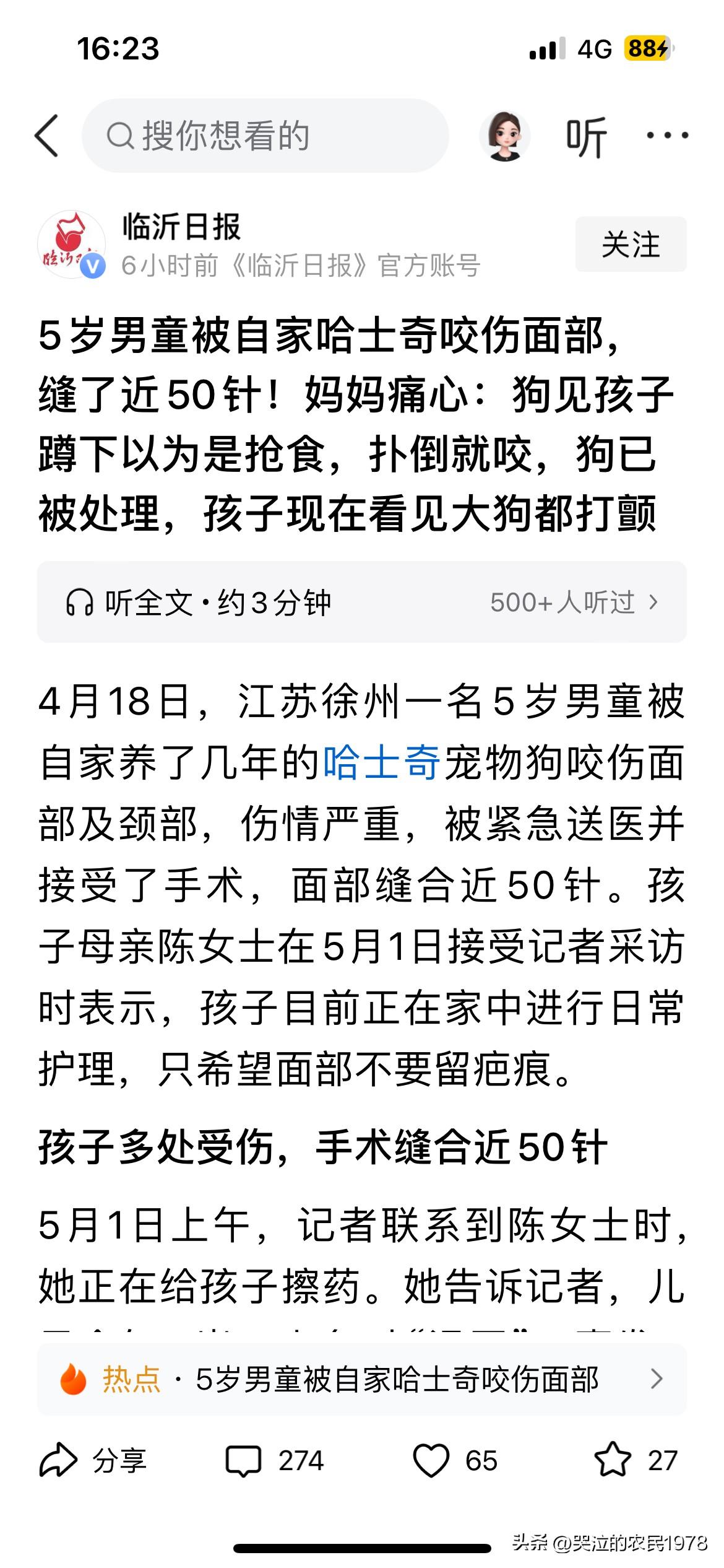 自己的狗狗咬到别人，爱狗人士一般是不会心疼的。但是爱狗人士的狗咬到自己家的孩子了