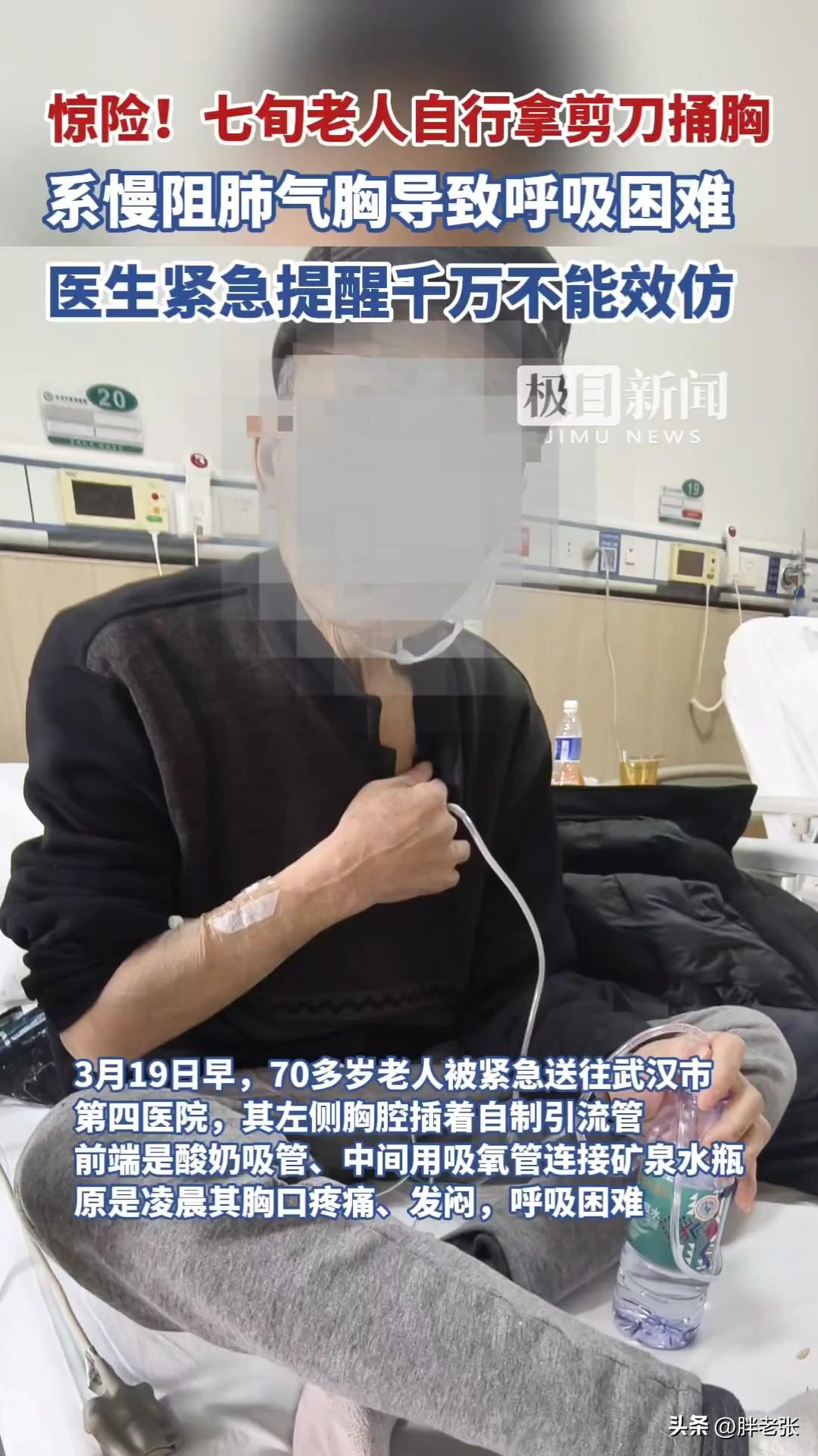 大爷太狠了！为了自救居然拿起剪刀对着自己戳进去！

近日，湖北的一位70多岁老人