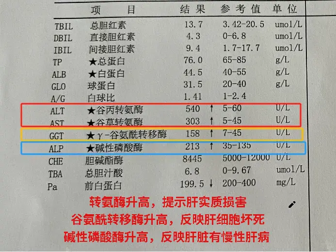 肝功能检查化验单怎么看？。这是一位来自山东聊城患者的肝功能化验单，从化...