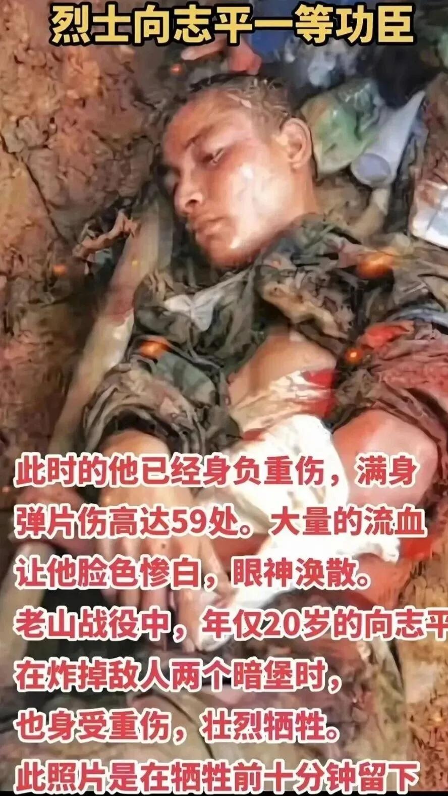 二十岁身带五十九处弹伤 向志平烈士永垂不朽
照片定格下向志平烈士牺牲前十分钟的模