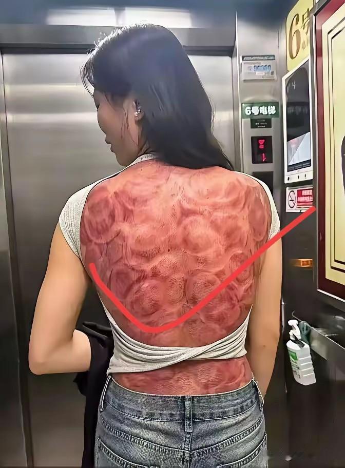 就这一拔，身上随他多少毒素都拔干净了！拔过后浑身轻松，舒服多了！