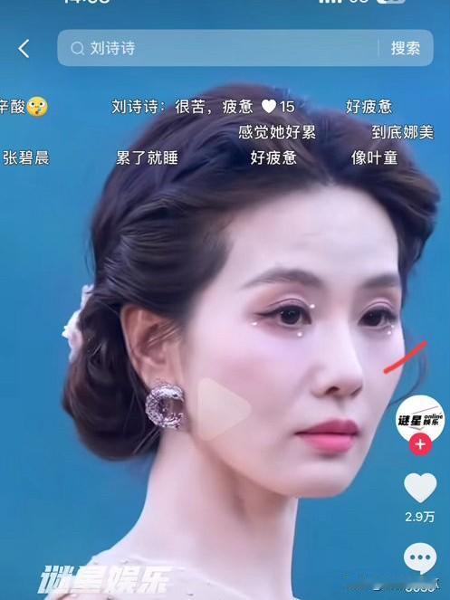 都说刘诗诗好疲惫
也说她老了不漂亮了
其实是她减肥过度了，她的皮肤状态是非常好的