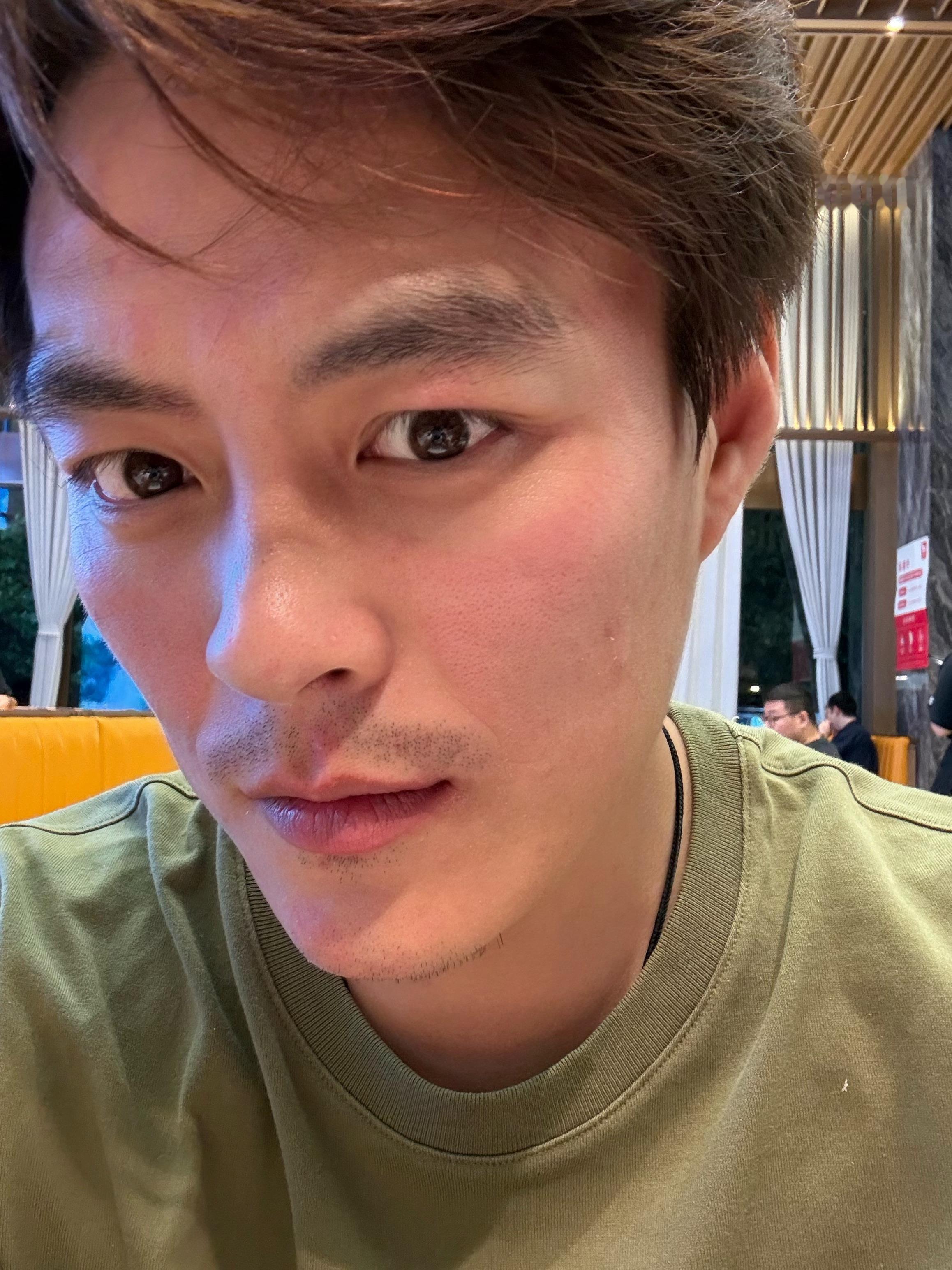 万万没想到，喝了这么多年的酒了今天过敏了。。。原因是我从来没有吃过和喝过百香果的