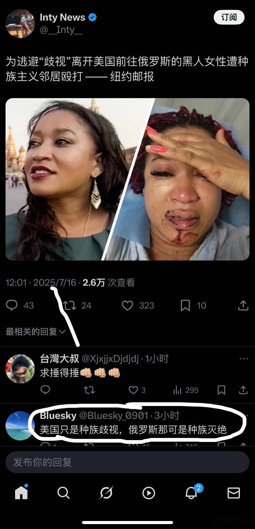 ‼️到俄罗斯去逃避种族歧视⁉️ ​​​