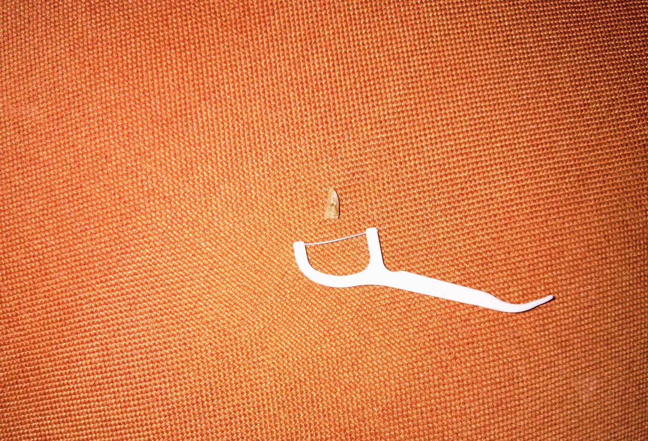 牙石终于掉下来了
左侧上牙上松动很久的牙石终于吊下来了。这几天它的位置变化很大，