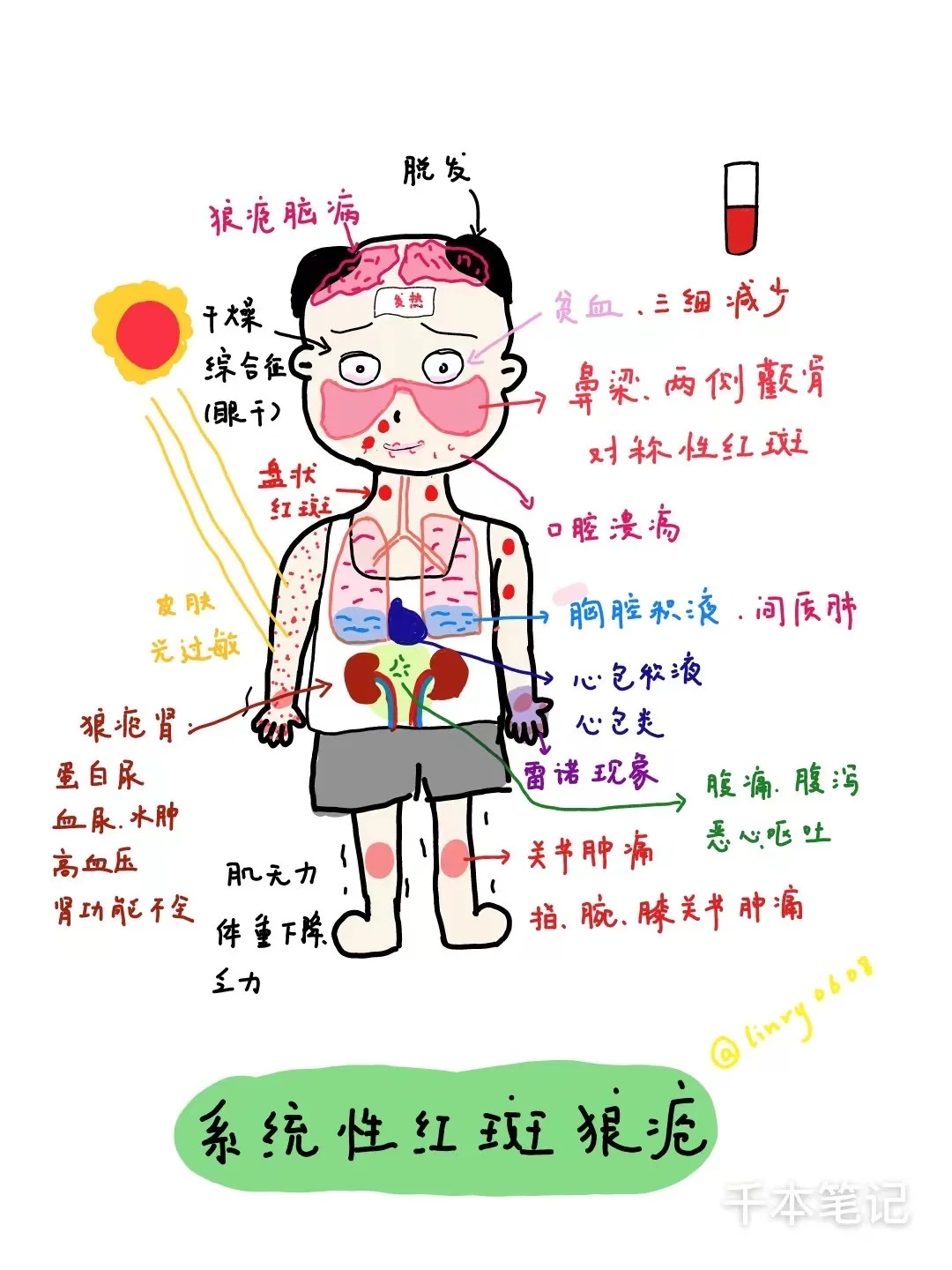 医学生绘本🎨第101弹【系统性红斑狼疮】