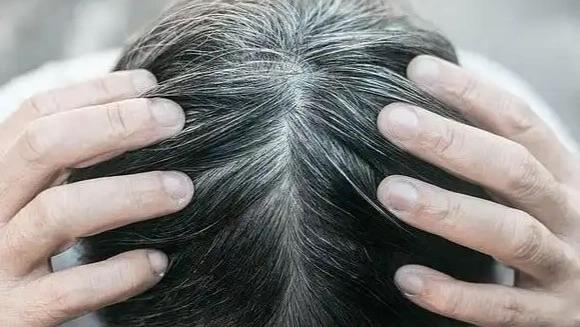 当下各类“逆转白发”产品充斥消费市场，多数宣称的黑发功效名不副实，部分产品更是暗