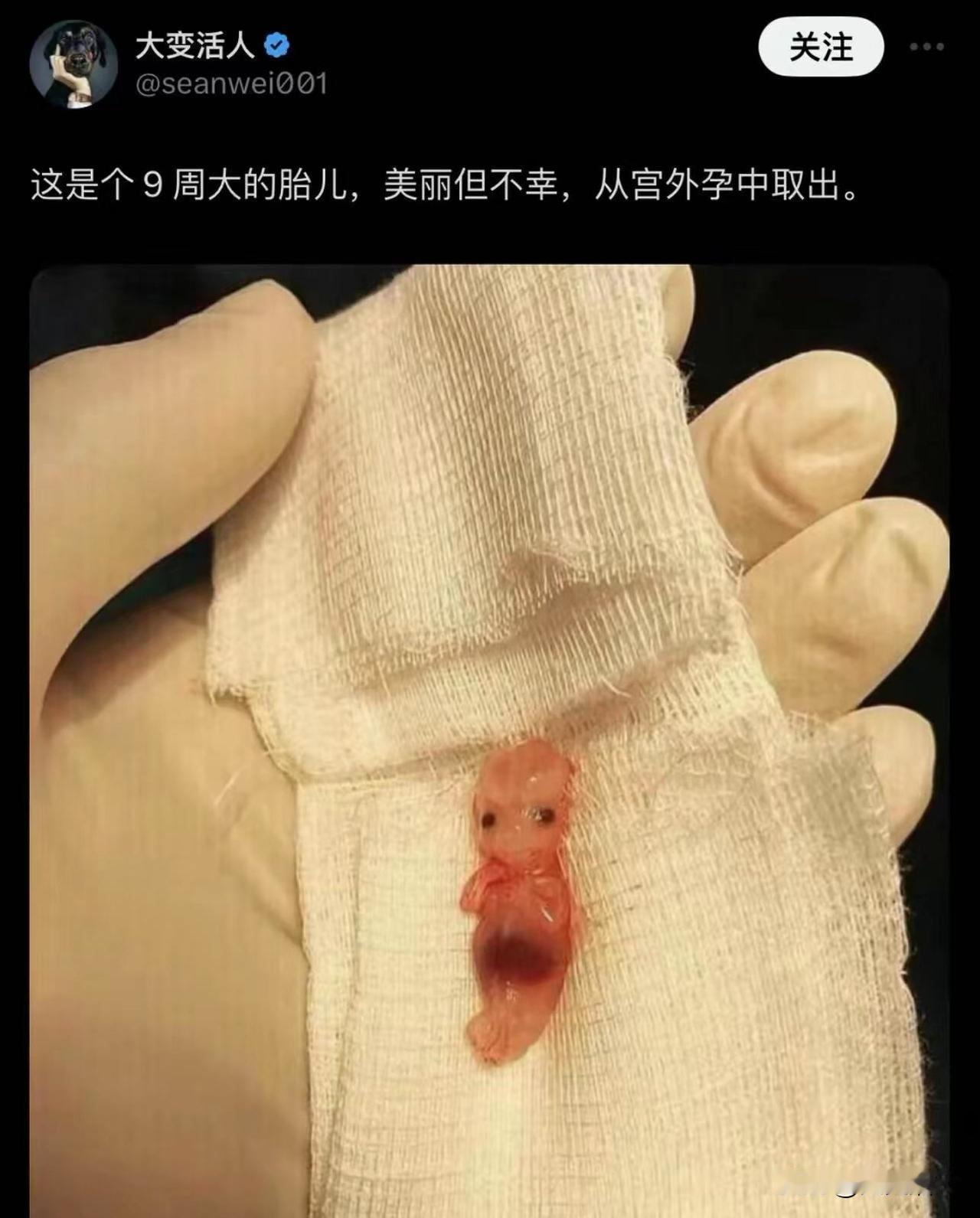 有没有人解释一下，这是真的吗？