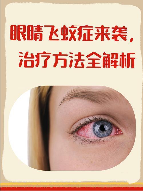 飞蚊症会不会影响视力？关键看这一点！
 
        飞蚊症是否影响视力，核