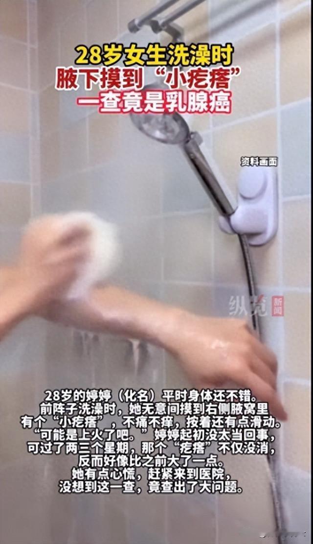 浙江一28岁女子洗澡时，突然感觉腋下有小疙瘩，不痛不痒，当时没太在意，后来去医院