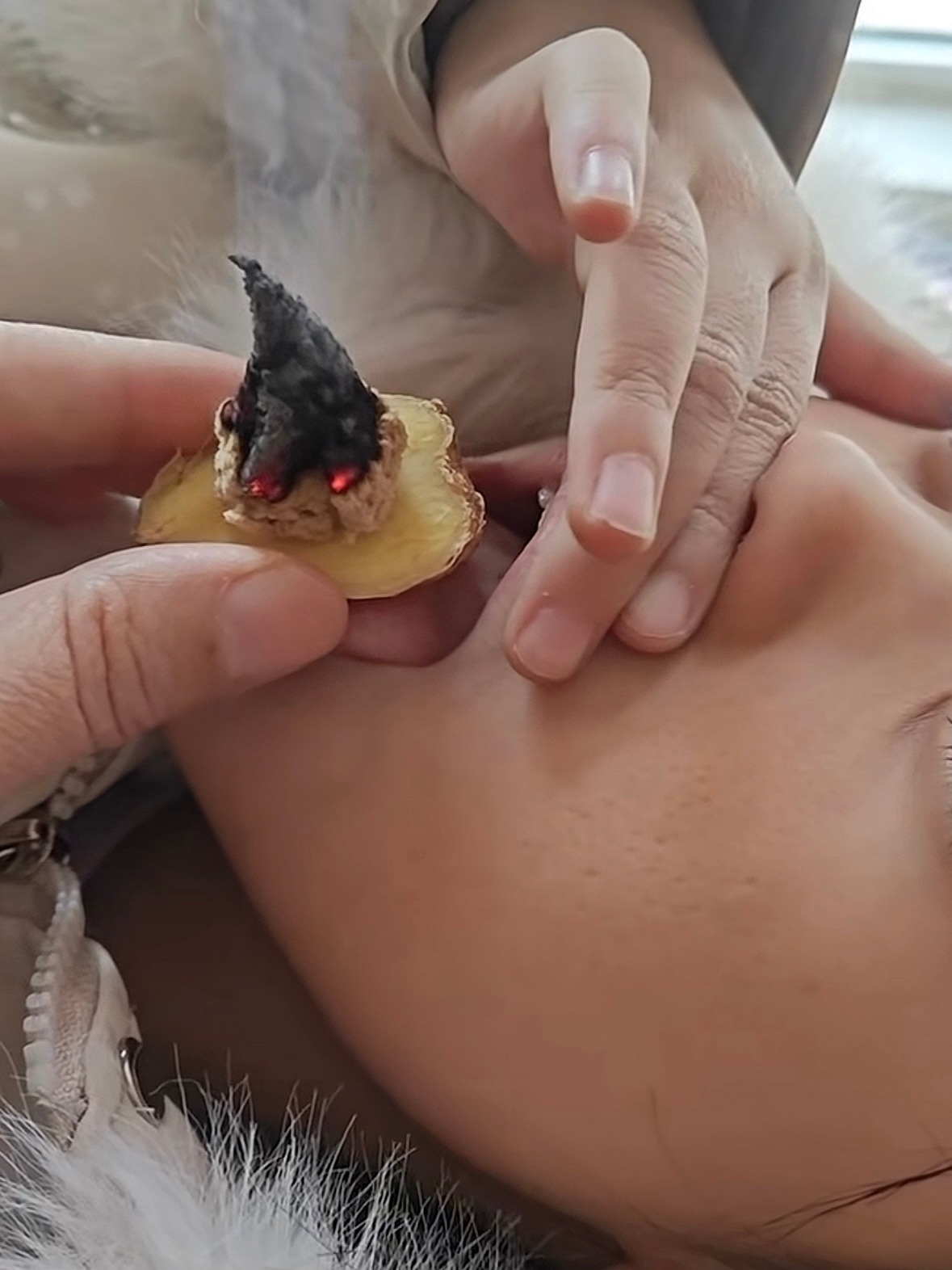 “热进入，凉出来。”一位家长给自己的女儿做“舌尖上的艾灸”。PM2.5和PM10