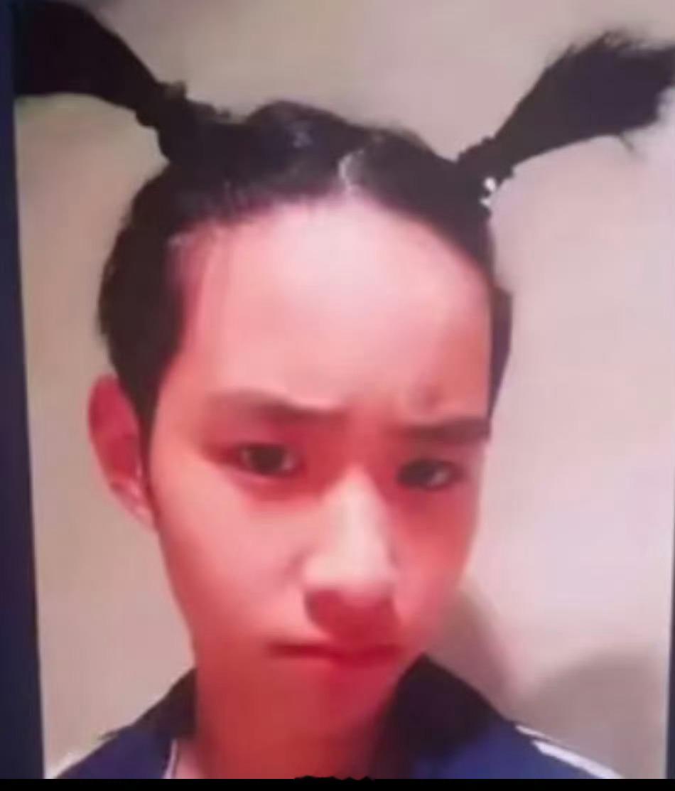 秒火里甄选发际线我咋看咋难受，于是搜他发际线得到此图啊啊啊啊： 
