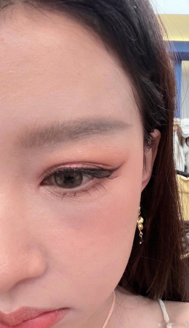 孙怡晒麦粒肿照孙怡得麦粒肿了孙怡得麦粒肿了，早日康复，蛙趣 