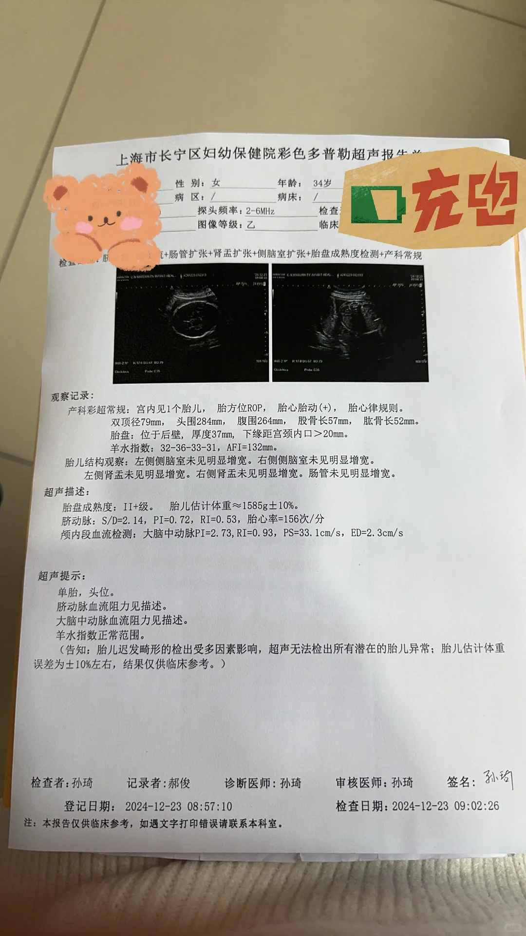 30w+2小排畸轻松过！大白却说宝宝超重了