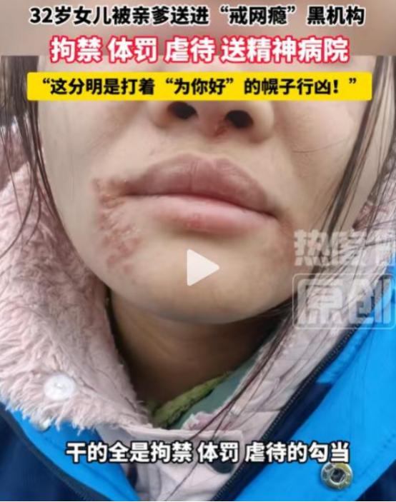 “都是为了你好”
 
太荒唐了！6 月 5 日报道，湖北一位父亲竟强行把 32 