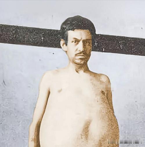 “他是被屎憋死的。”1940年，一美国男人因为三年没有排泄，最终不幸去世，医生检