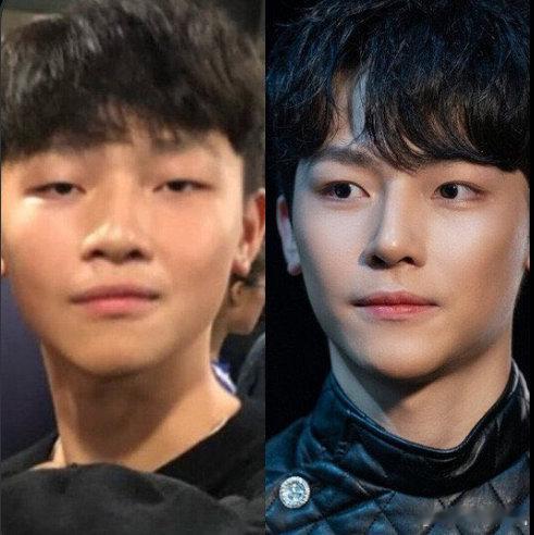 这是尼古拉斯吗？被韩国人挖出来变身前后了 