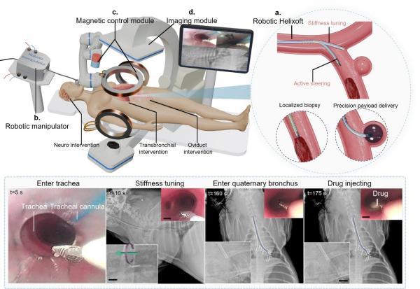 【磁控微米机器人导管研究获突破】在支气管、脑血管、输卵管等狭窄而曲折的自然腔道中