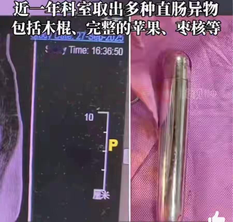 建议部分特殊癖好的人不要太离谱
这样做有一定的危险性，那地方是个出口，只有这唯一