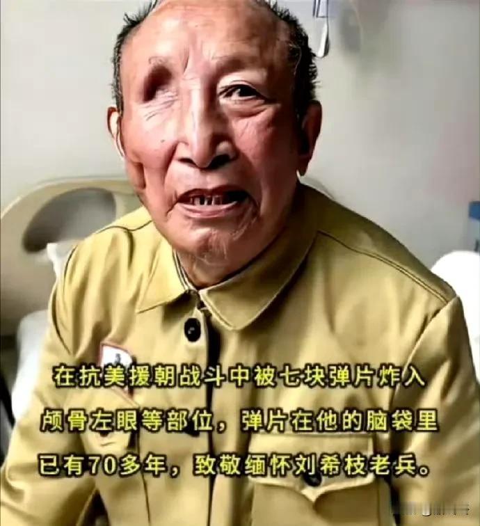 七块弹片炸入颅骨、左眼等部位，并且在脑袋里留存了70多年，这得承受多大的痛苦啊！