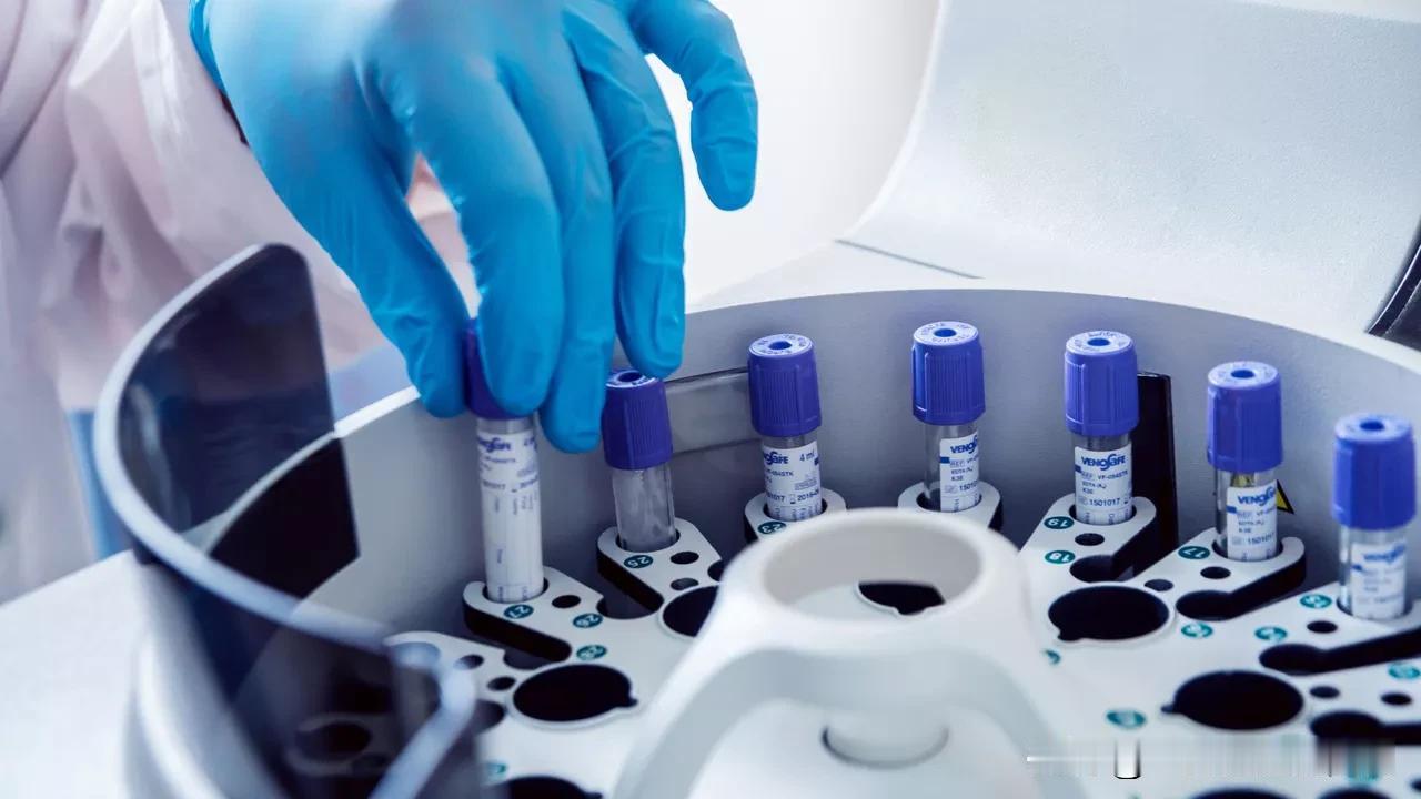 俄罗斯联邦生物医学署表示，俄产新型抗癌药物Rakurs（223Ra）具有显著治疗