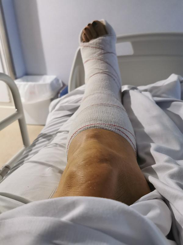 右腿骨折术前一天，一个新来的实习护士拿了个一次性剃毛刀过来的跟我说“明天你要手术