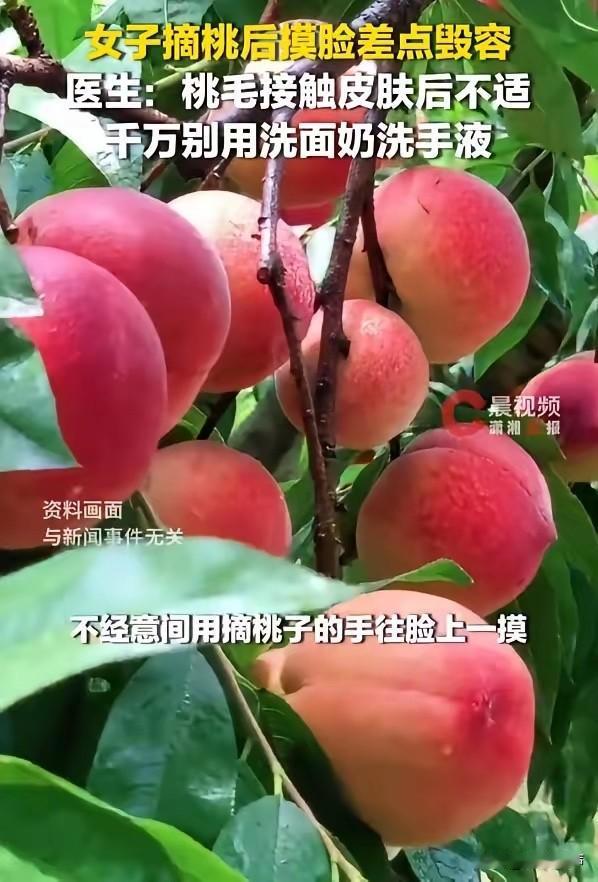 “悲剧还是发生了！”6月14日报道，浙江杭州，一女子摘桃子时，手沾了桃毛，随后用