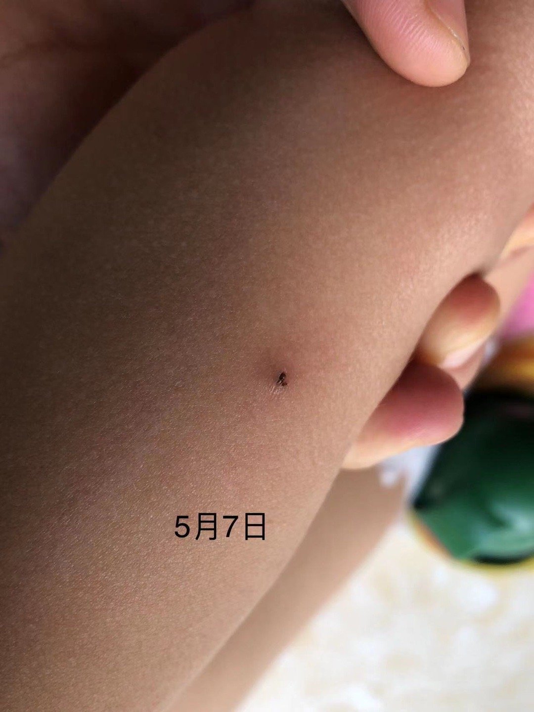 #宝妈咨询# 健康群宝妈：童爸，请问可以帮忙看一下吗？孩子隔壁上最开始是一个黑色