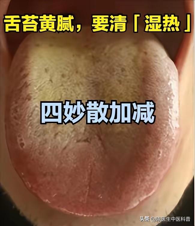 舌苔黄腻＝湿热重！清利湿热，舌苔清爽、人也清爽
 
大家好，我是中医陈大夫！
 