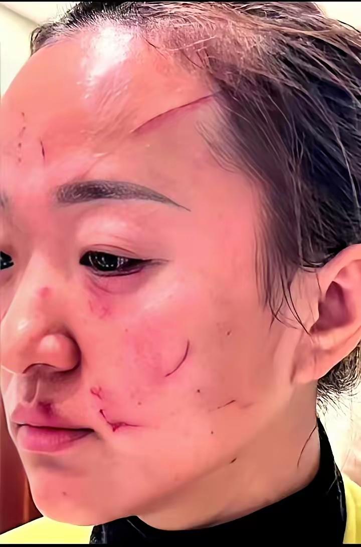 河南洛阳某小区又出大事了！一段婆媳扭打视频冲上热搜，短短二十秒，儿媳脸上就被指甲