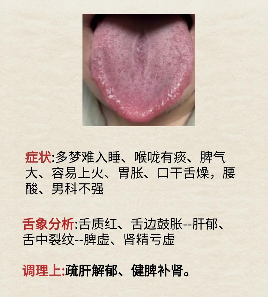 武医生舌诊案例分析#中医健康##健康养生#