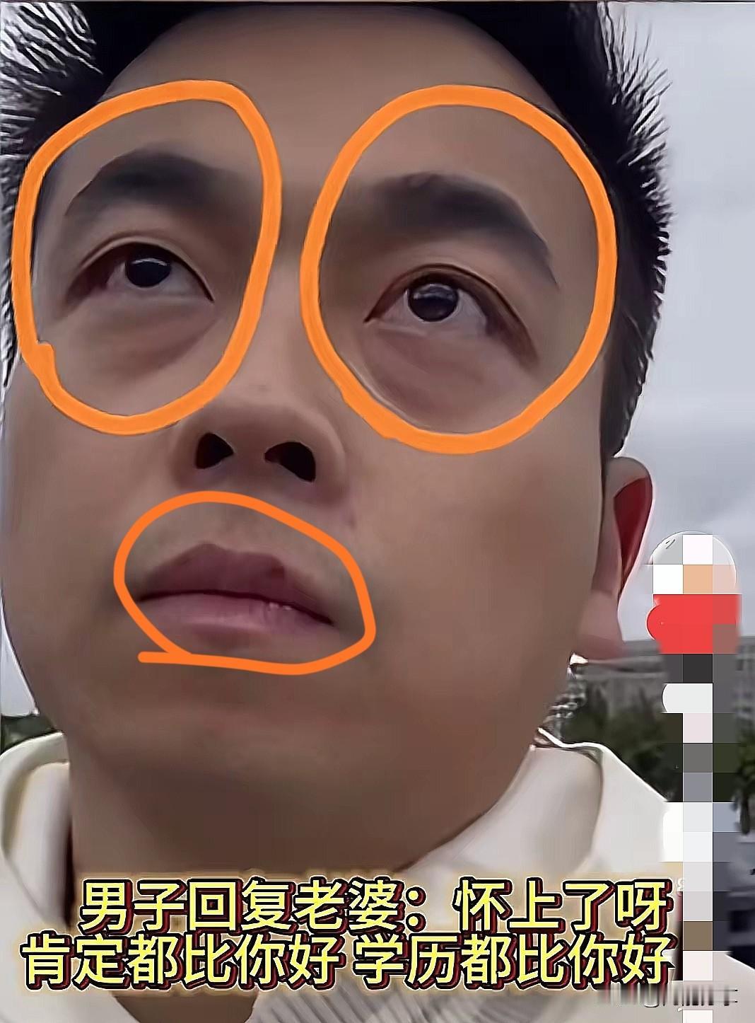 许律师这事儿应该早有苗头！
不信你看，
一个才30多岁的人，
眼下的淤青有多严重