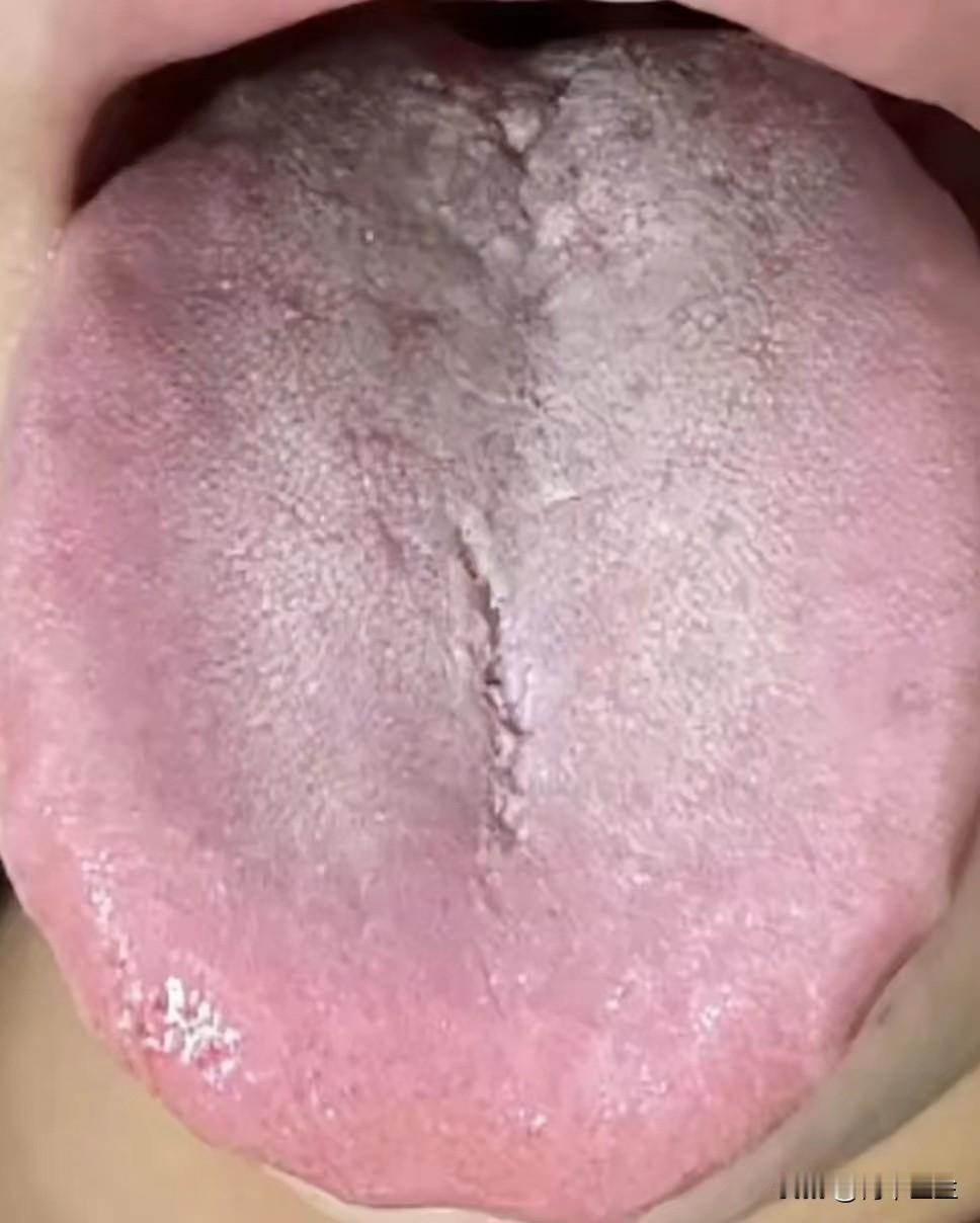 女性也会肾虚，症状比男性还严重，有这样的症状就长点心吧

 今天看诊的这个女患者