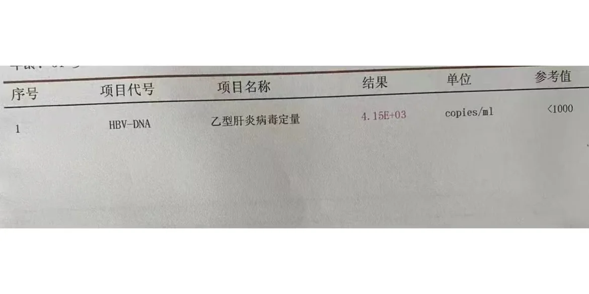乙肝小三阳病毒量10的3次方需要抗病毒治疗吗？ 近期有个山东临沂的患者...