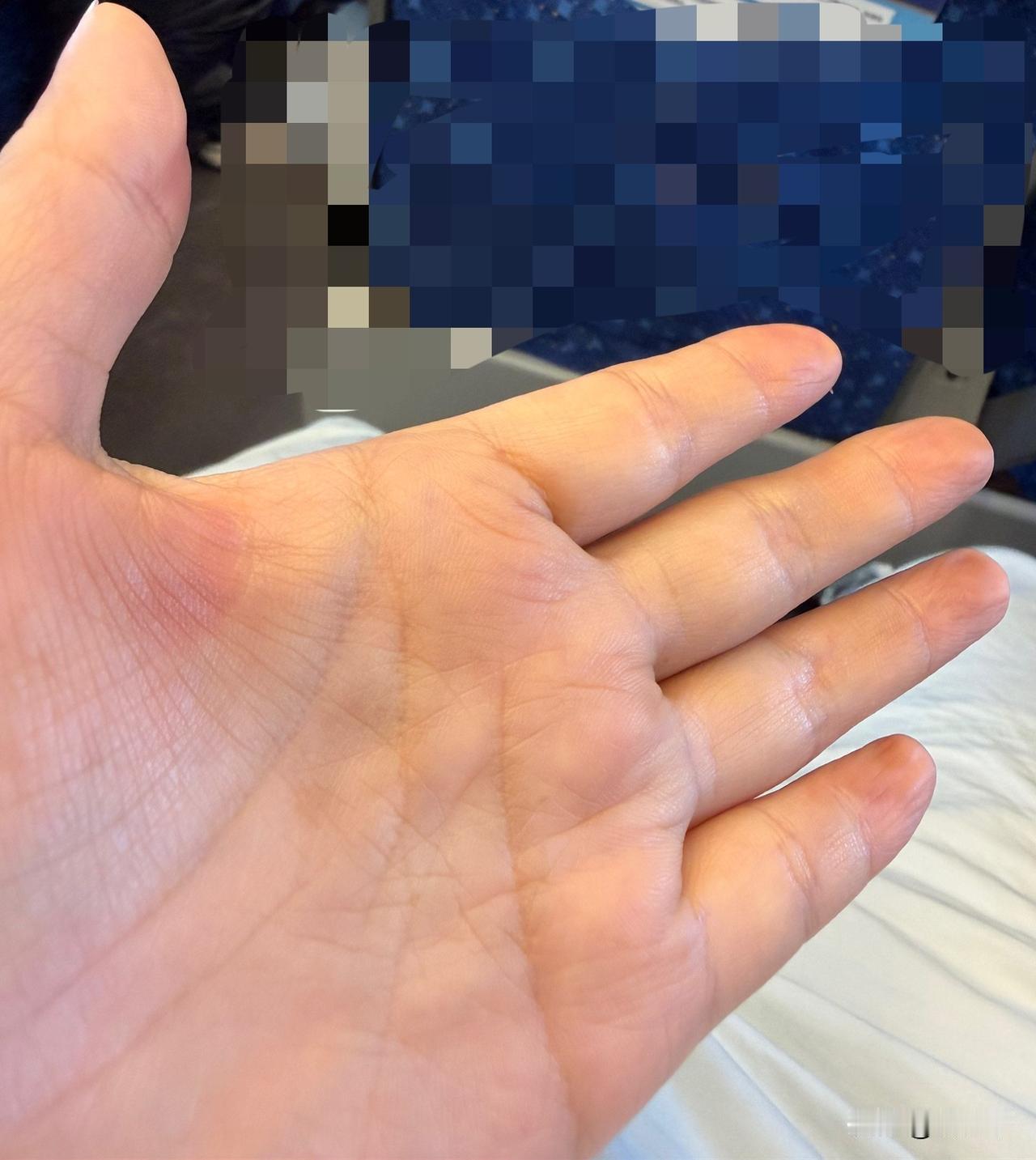 削了一个青核桃，结果弄得一手青绿，怎么也洗不干净。

姐家院子里种了一棵核桃树，