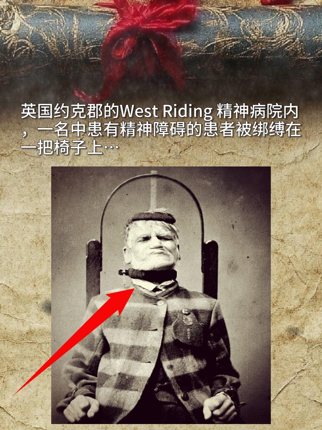 英国约克郡的West Riding 精神病院内，一名中患有精神障碍的患...