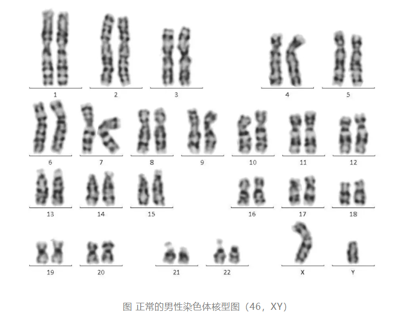 #26岁女子体检才知自己染色体为男性# 【26岁女子体检才知：自己染色体竟为男性