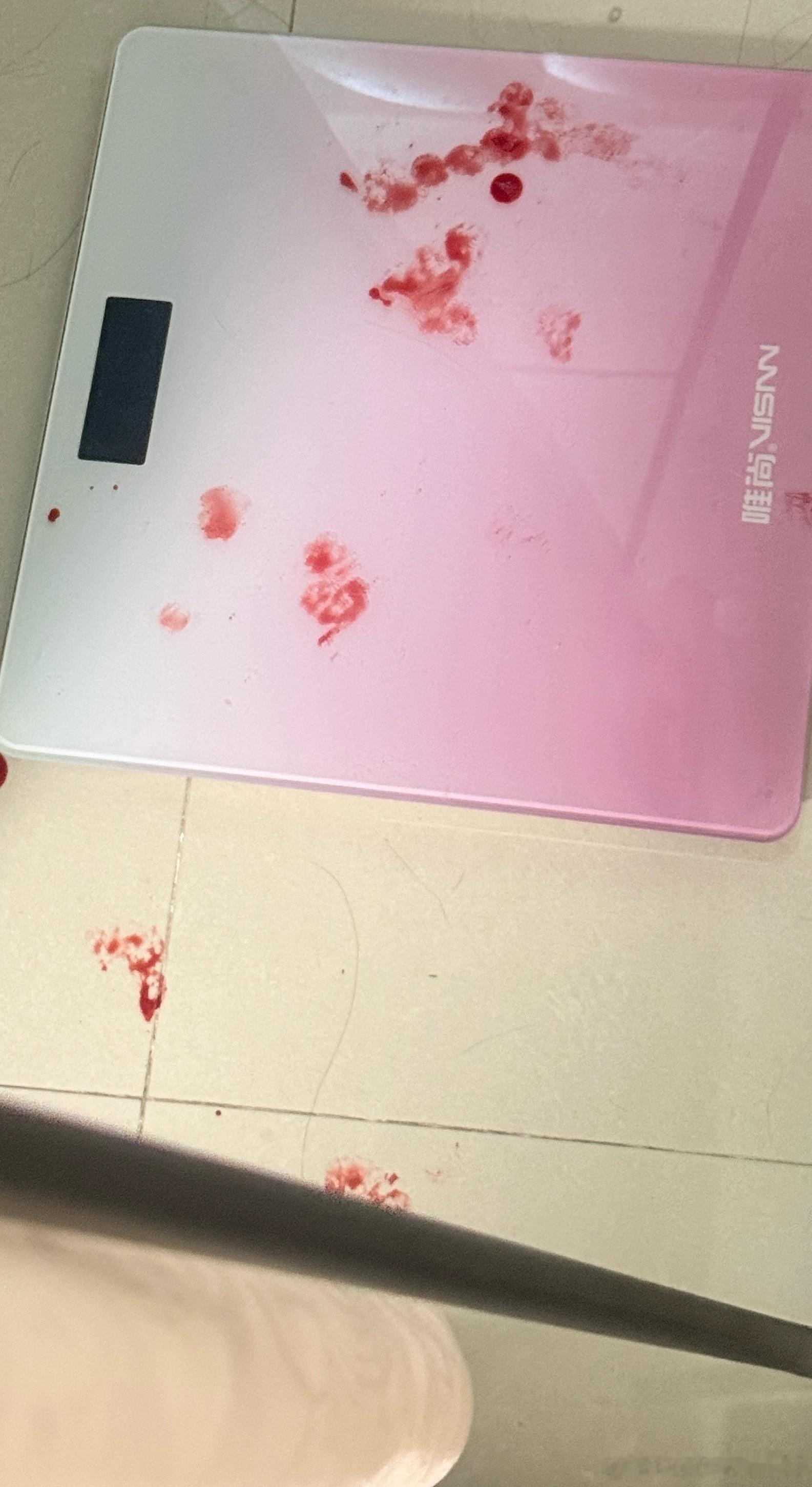 有时候真想送人 每天乱尿也就算了 今天直接打出血了再来一次我一定只养瓜猫 