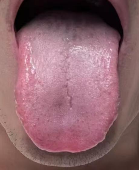 男士机能偏弱？上补心、中健脾、下补肾，三脏同调恢复状态






很多男同志出